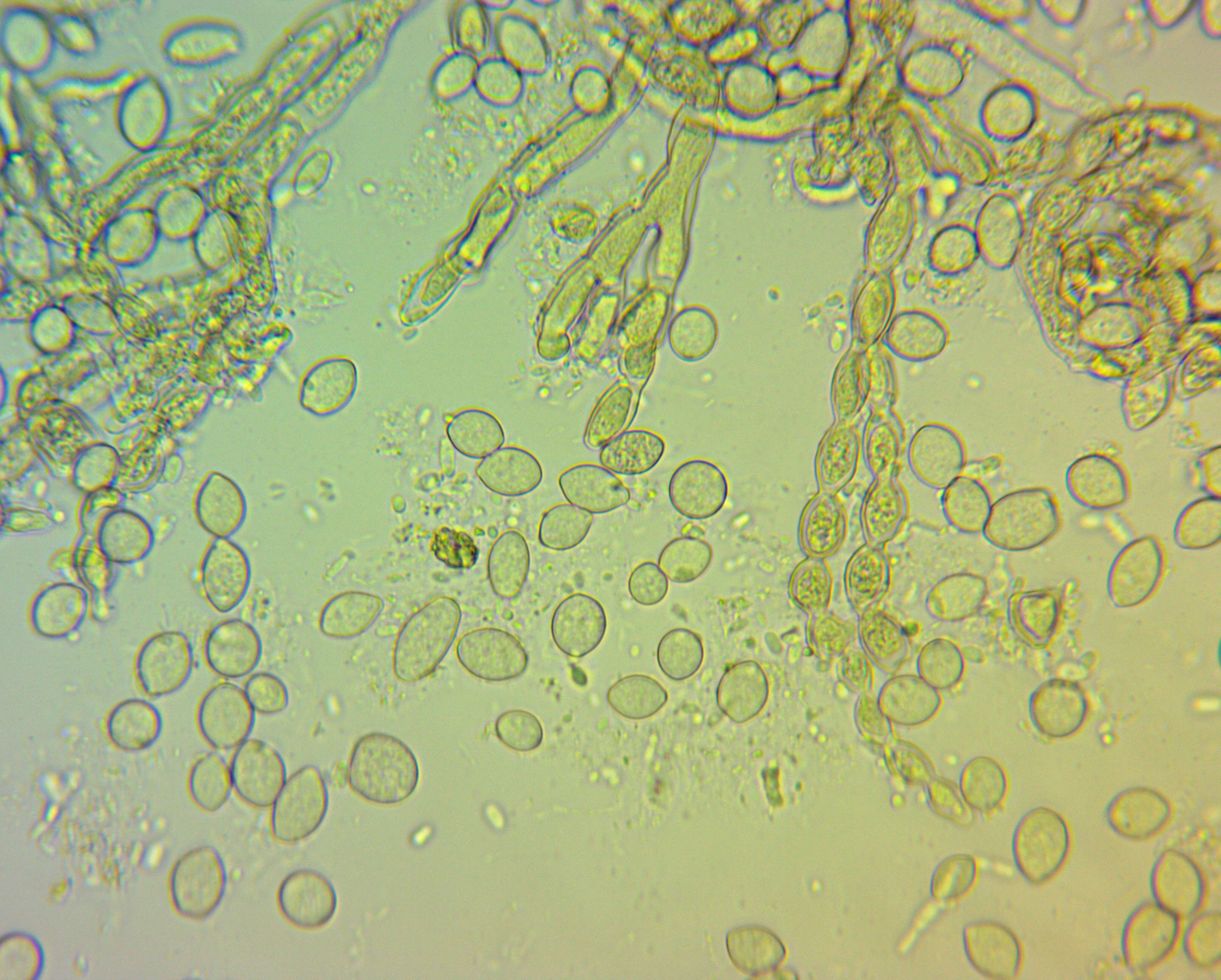 Image of Monilinia fructicola (G. Winter) Honey 1928