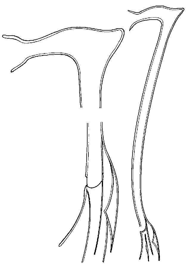 Image of Promesostoma digitosum Ax 1995