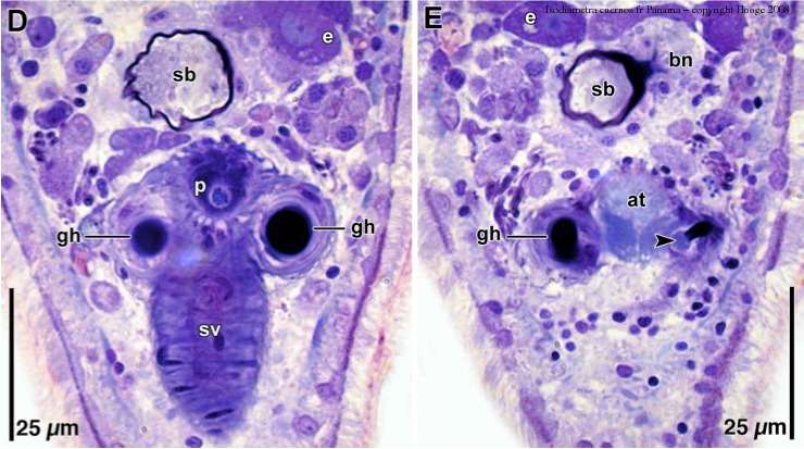 Image of Isodiametra cuernos Hooge & Tyler 2008