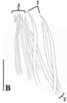 Image of Parotoplana varispinosa Delogu, Casu & Curini-Galletti 2008