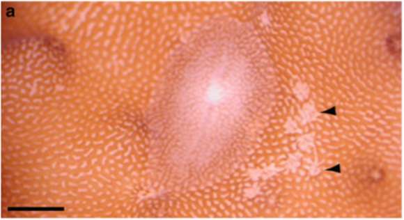 Image of <i>Prosthiostomum acroporae</i>