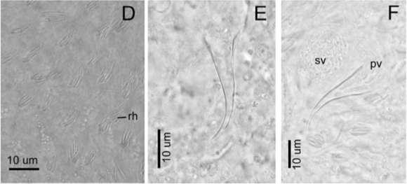 Image of Macrostomum platensis Adami, Damborenea & Ronderos 2012