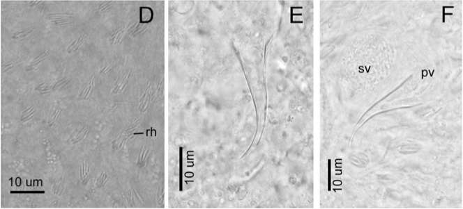 Image of Macrostomum platensis Adami, Damborenea & Ronderos 2012