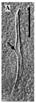 Image of Limipolycystis libra Artois, Willems & Schockaert 2012