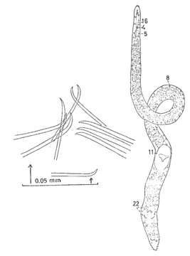 Image of Coelogynopora tenuiformis Karling 1966