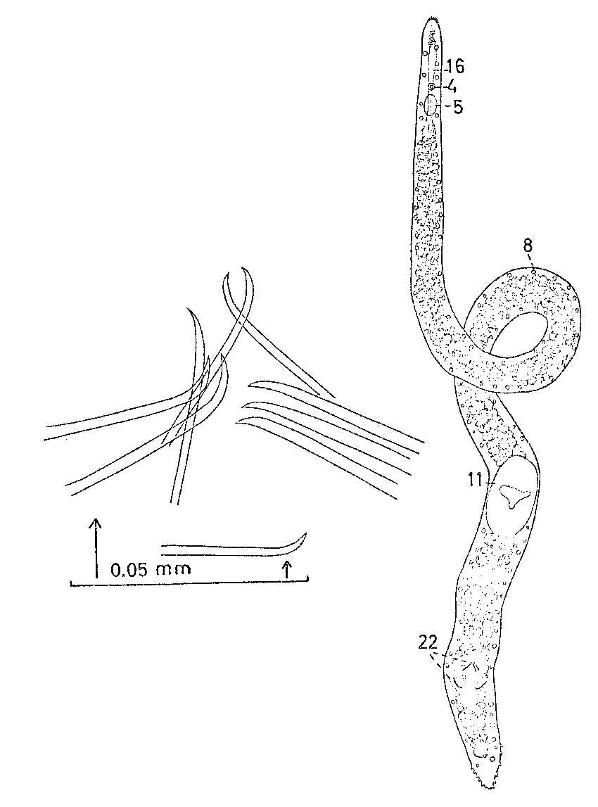 Image of Coelogynopora tenuiformis Karling 1966