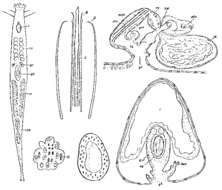 Image of Postbursoplana