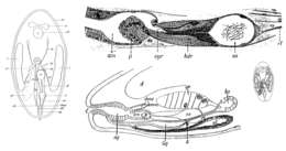 Image de Anoplodium stichopi Bock 1925