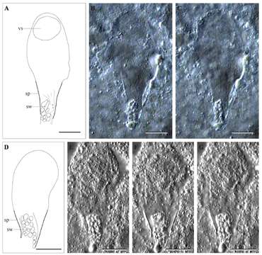 Image of Acrochordonoposthia