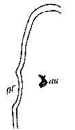 Image de Strongylostoma gonocephalum (Silliman 1884)