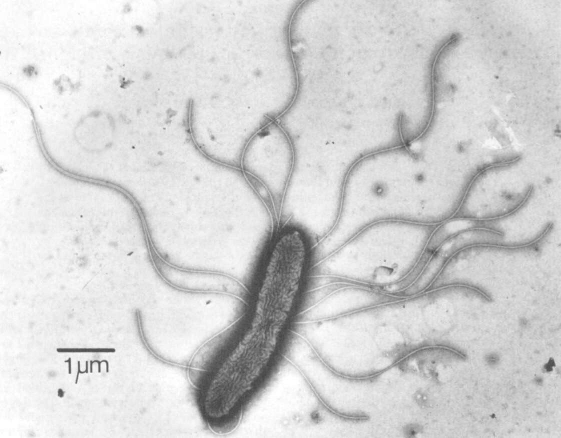 Image of Achromobacter ruhlandii