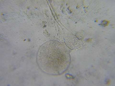 Image of Walkerioidea