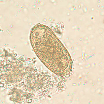 Imagem de Capillaria philippinensis