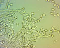 Image of Monilinia fructicola (G. Winter) Honey 1928