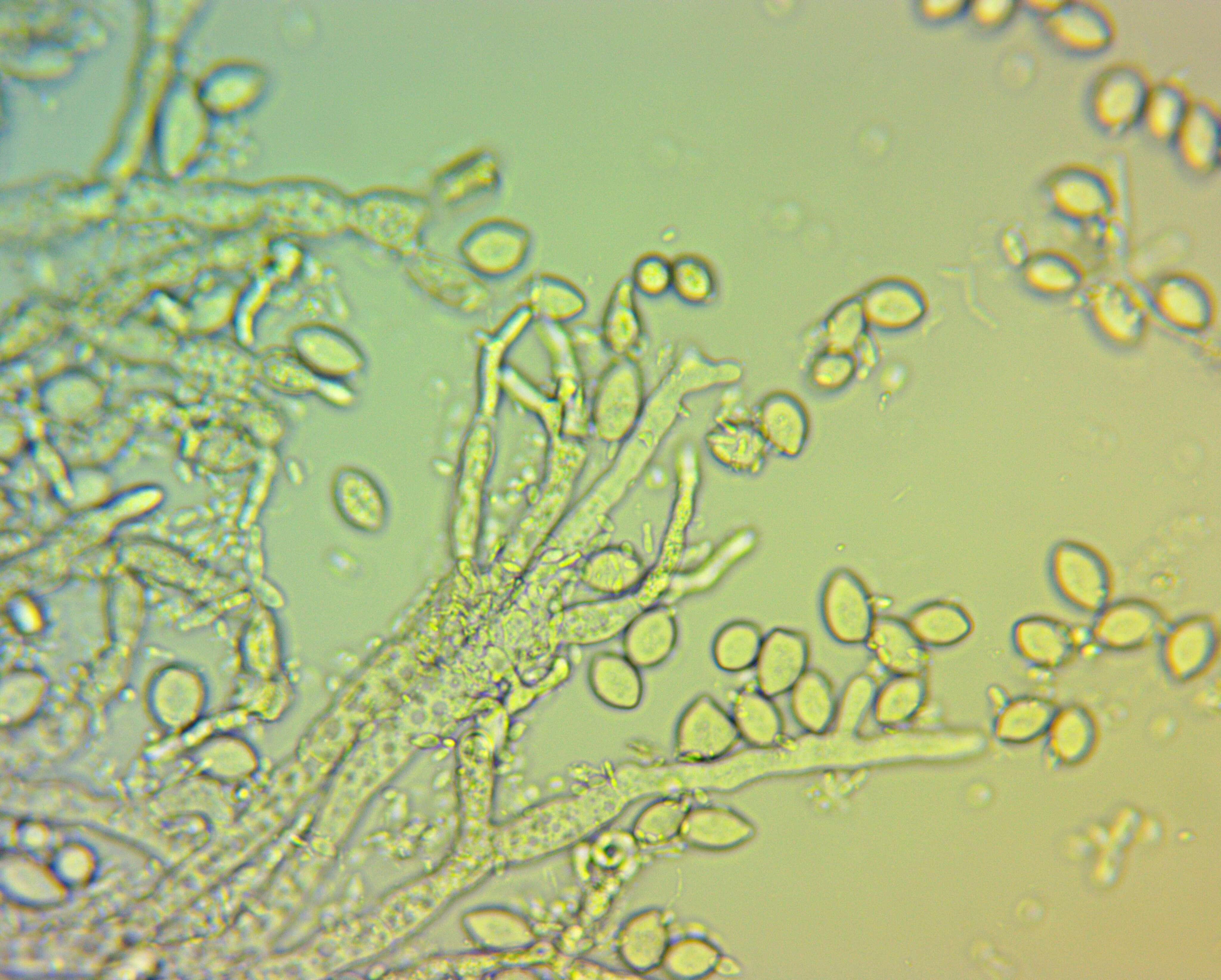 Image of Monilinia fructicola (G. Winter) Honey 1928