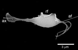 Image of Trichomonas Donné