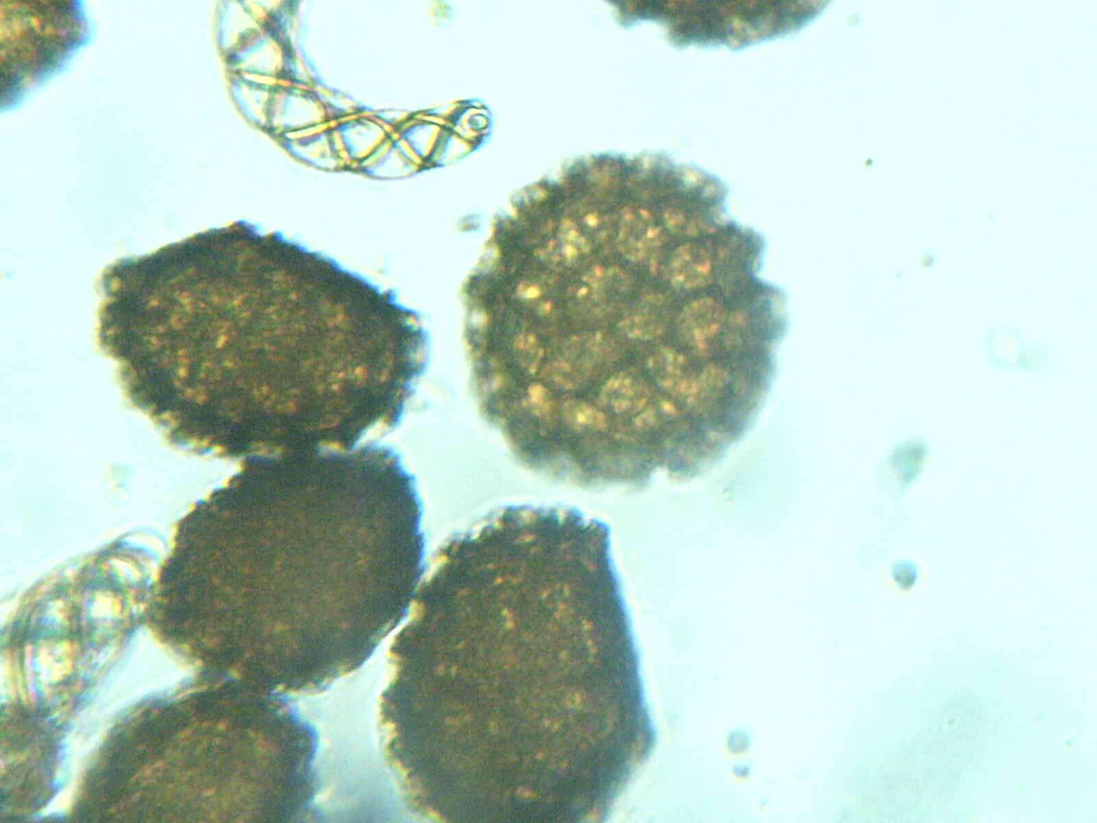 Image of Fossombronia foveolata Lindb.