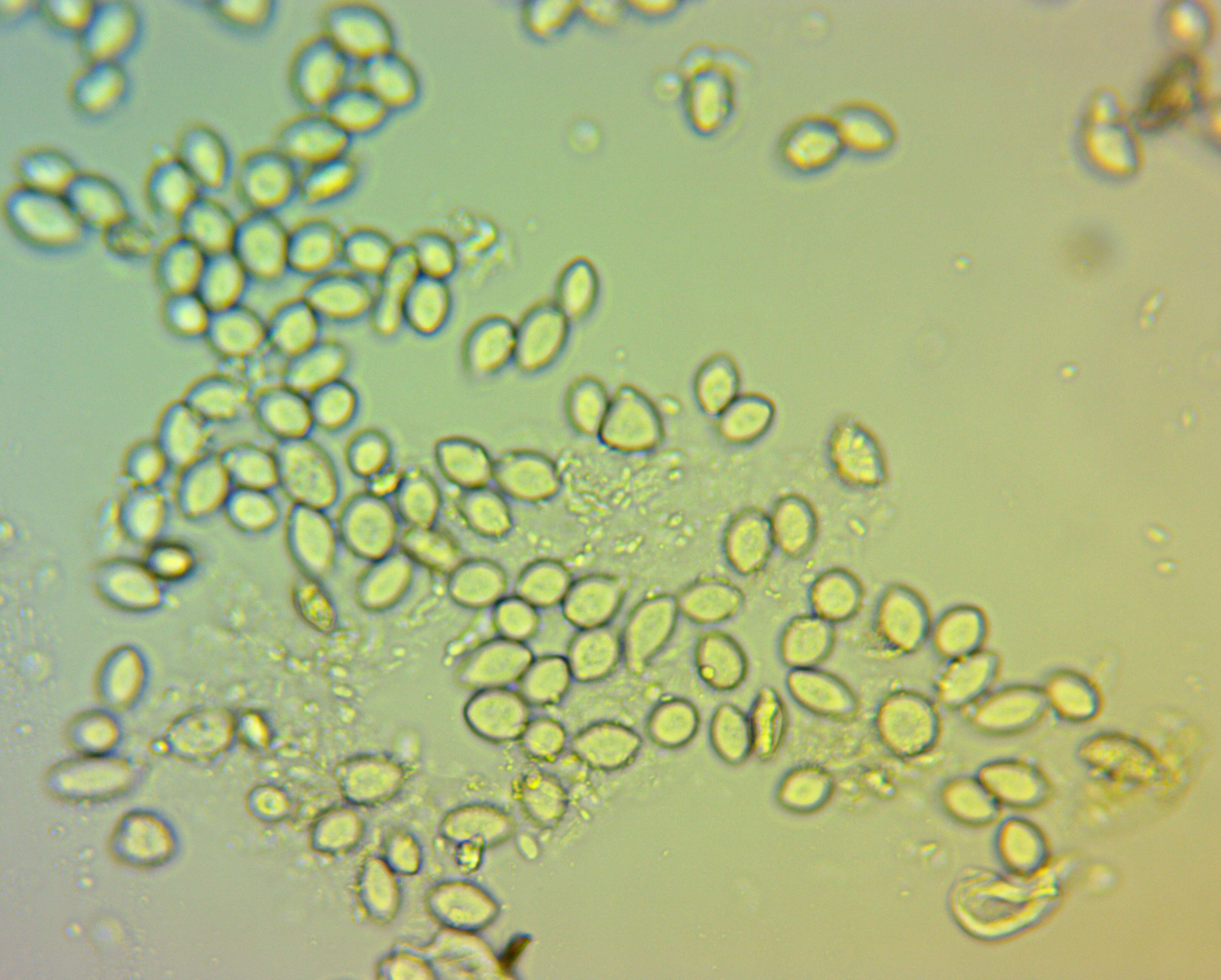 Image of Monilinia fructicola (G. Winter) Honey 1928