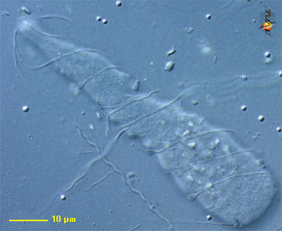 Image of Pyrsonymphidae