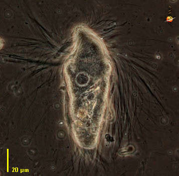 Image of Spirotrichonymphida