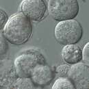 Image of Acanthamoeba