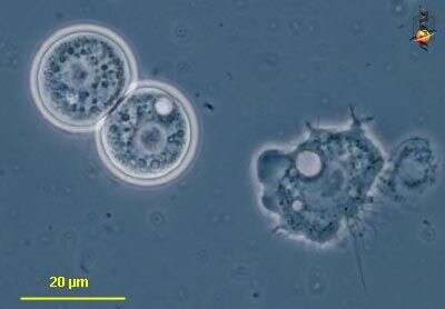 Image of Protacanthamoeba