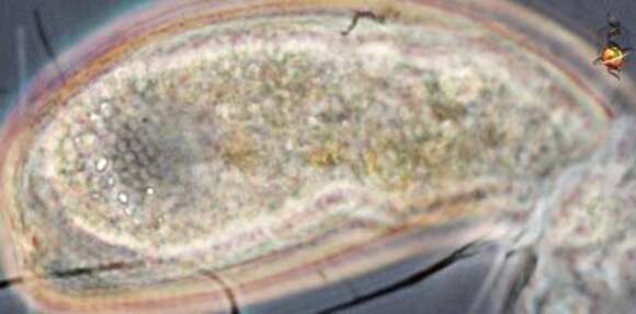 Image of Cyphoderiidae