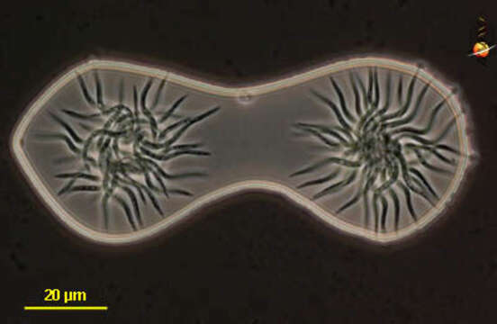 Image of Ankistrodesmus Corda 1838