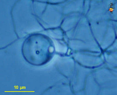 Image of chitridiomycetes