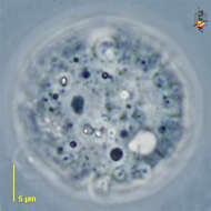 Image of testate lobose amoebae