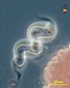 Image of purple sulfur bacteria