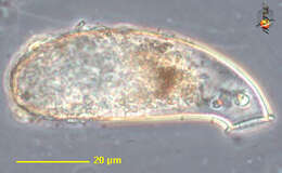 Image of Cyphoderiidae