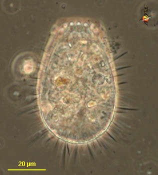 Слика од Euglyphidae