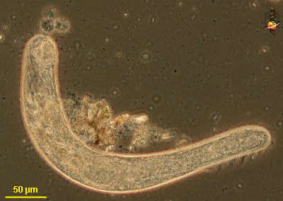 Image of Spirostomidae