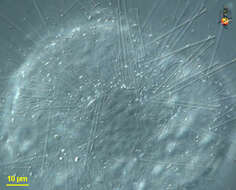 Image of Acanthocystis Carter 1863