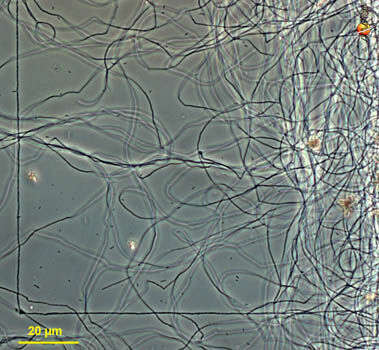 Hydrogenobaculum acidophilum的圖片