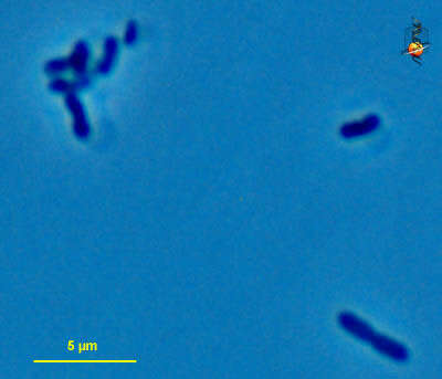 Hydrogenobaculum acidophilum的圖片