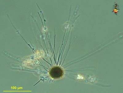 Image of Cyanobacteria/Melainabacteria group
