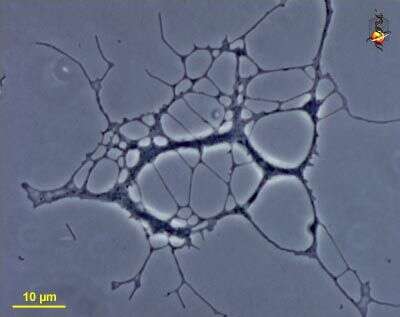 Image of Corallomyxa