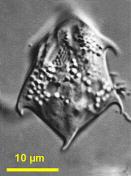 Image of Petalomonas spinifera (Lackey) W. J. Lee & D. J. Patterson 2000