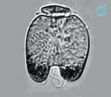 Image of Amphidinium bipes Herdman 1924