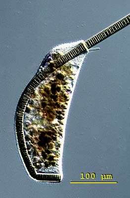 Imagem de Nassulopsis elegans (Ehrenberg 1834) Foissner, Berger & Kohmann 1994