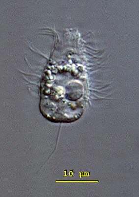 Image of Urotricha farcta Claparède & Lachmann 1859