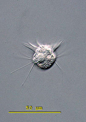 Image of jumping oligotrich