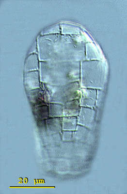 Image of Quadrulella symmetrica
