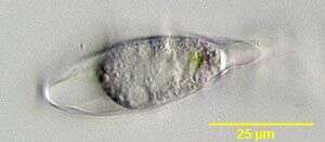 Image of Hyalosphenia