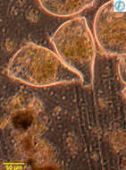 Image of Epistylidae