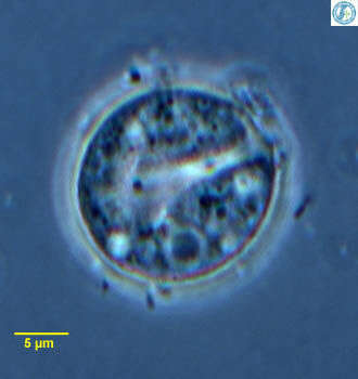 Image of Microchlamys