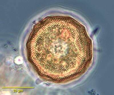 صورة Arcella gibbosa