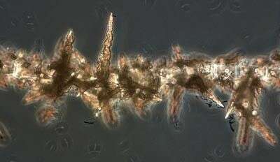 Zygogonium Kützing 1843的圖片